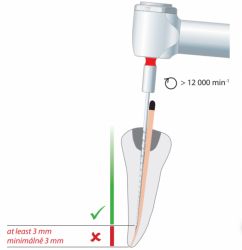 Gutta Condensor